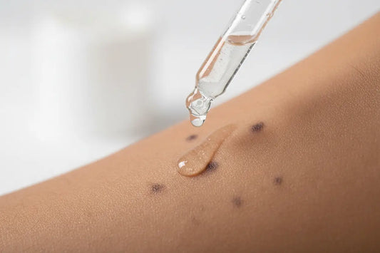 How to Remove Dark Spots on Face Fast at Home