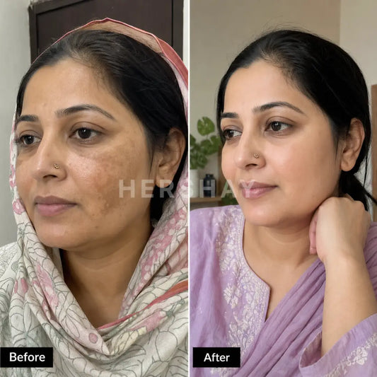 Before and after comparison of a woman with visible skin texture changes.

