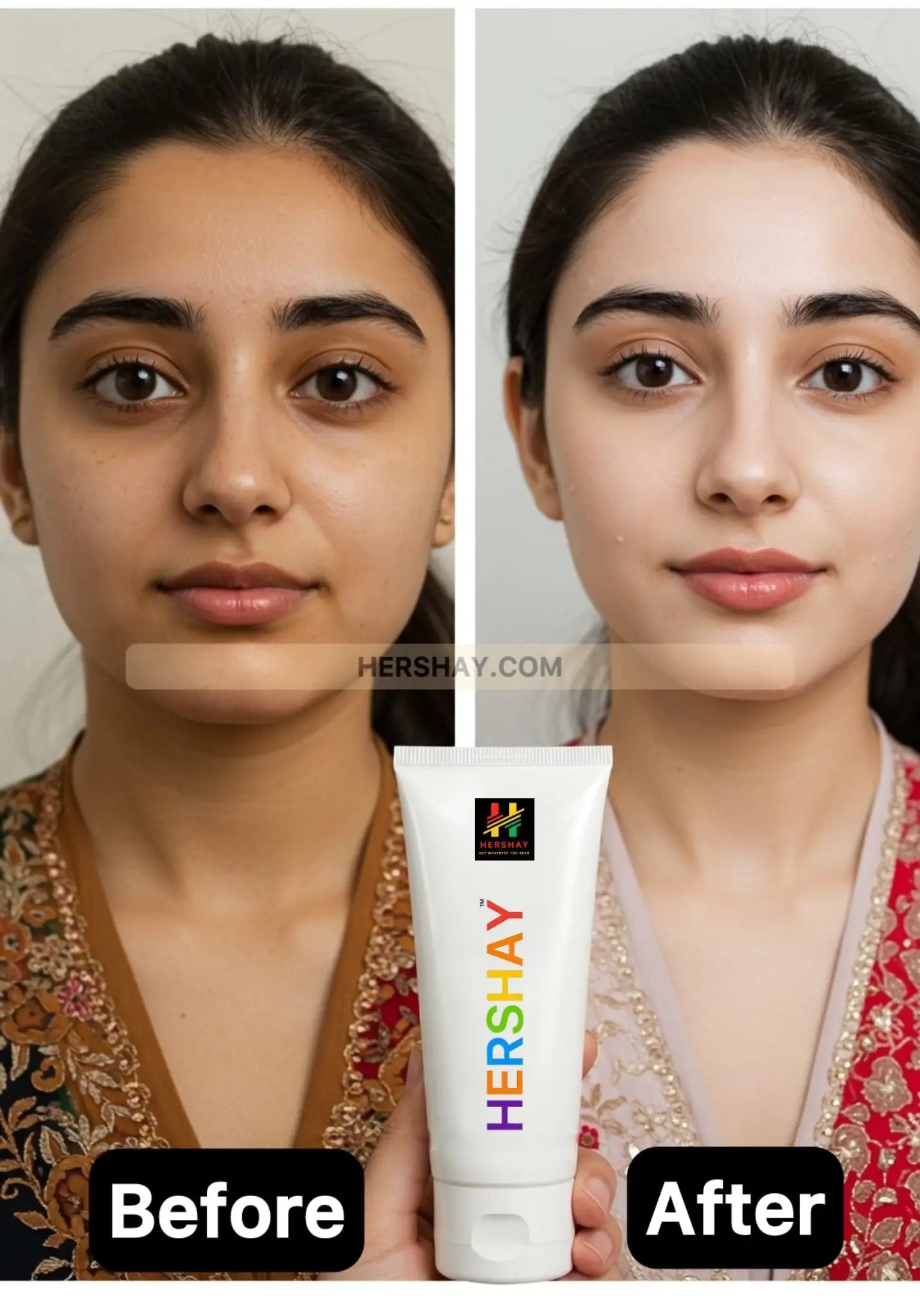 Before and after comparison of a woman using Hershay skincare product.