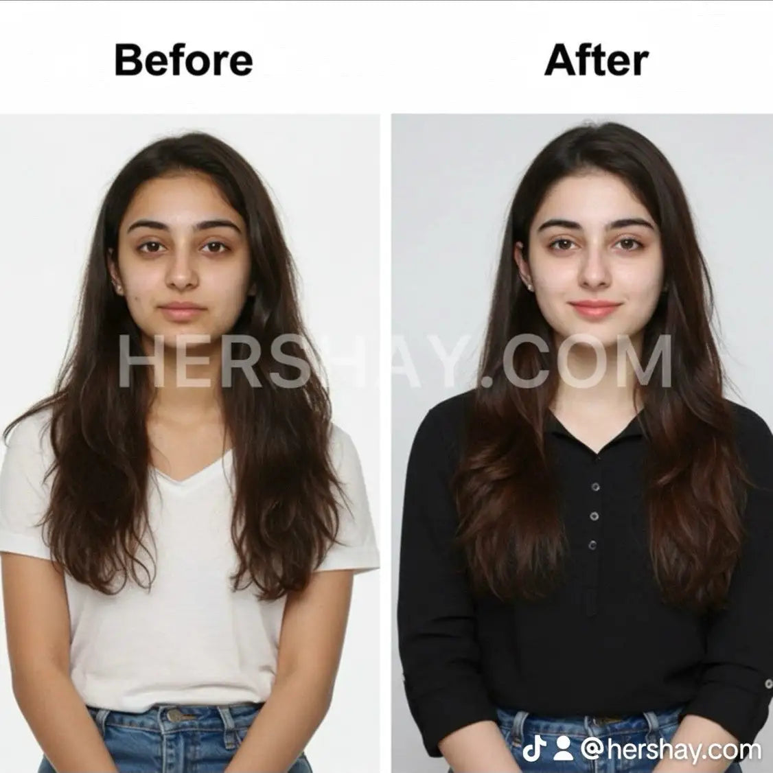 Hershay Before and after comparison of a person after using brightening cream